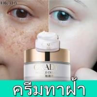 ราคา OKADY ครีมไวท์เทนนิ่ง ครีมทาฝ้าหนาๆ ครีมทาฝ้า ฝ้า กระ จุดด่างดำ สีผิวกระจ่างใส ครีมทาฝ้ากะ ครีมทาฝ้า ครีมทาฝ้ากระ 6160 (7179696974)