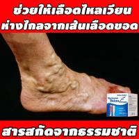 ราคา ไม่ได้ผลคืนเงิน Varicose Vein Cream ครีมทาสำหรับเส้นเลือดขอด ขาสวย ลบเส้นเลือดขอด รักษาขาให้สวย ครีมทาเส้นเลือดขอด ครีมเส้นเลือด ขนาด 20กรัม (23121949818)