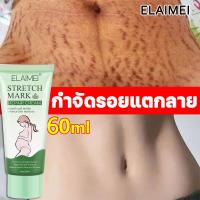 ราคา ครีมรอยแตกลาย 60ml ครีมทาท้องลาย ครีมทาขาลาย ลดรอยแตกลาย ลดรอยแตก อ่อนโยนไม่ระคายเคื ครีมทาหน้าท้อง ครีมทาขาแตกลาย ครีมลดรอยแตกลาย ครีมแก้ท้องลาย ลดผิวแตกลาย กันท้องลาย ครีมท้องแตกลาย (23067759539)