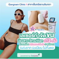 ราคา E voucher Gangnam Clinic โปรแกรมเลเซอร์กำจัดขน Advance Diode 3 พลังงาน กำจัดขนบราซิลเลี่ยน (23270829399)