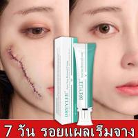 ราคา ส่วนลดครบรอบร้านค้า 70 breylee ครีมกำจัดแผลเป็น กำจัดแผลเป็น ครีมกำจัดรอยสิว ยาทาลบรอยแผลผ่าตัด แผ่นซ่อมแซมหลุมสิว หน้าไหม้ 7วันได้ผลรวดเร็ว เจลลบแผลเป็น (18492308730)