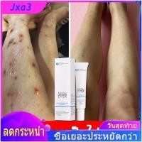 ราคา ได้ผลเร็ว SKINEVERยาทาแผลเป็น ครีมลดรอยสิว 30g ซ่อมแซมรอยแผลเป็นและส่งเสริมการสร้างเซลล์ใหม่ ยาลบลอยแผลเป็น ครีมลบแผลเป็น ลดรอยแผลเป็น ลบรอยแผลเป็น ครีมซ่อมแซม ครีมลดรอยแผลเป็น ครีมลบรอยแผลเป็น แผลผ่ 