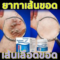 ราคา เส้นเลือดขอด ครีมเส้นเลือดขอด ส้นเลือดขอด ครีมทาเส้นขอด ครีมทาเส้นเลือดขอด แมงมุมเส้นเลือดปวด Varicose Vein Creamรักษาขาให้สวย (18705512350)