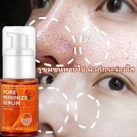 ราคา ครีม แก้ ฝ้า กระ ครีมทาฝ้ากระ ครีมแก้ฝ้าถาวร ครีมหน้าขาวใส ครีมแก้ฝ้าแท้ๆ Vit C ครีมทาหน้าขาว ลดฝ้ากระ จุดต่างๆ ไวท์เทนนิ่ง ให้ความชุ่มช (13176364439)