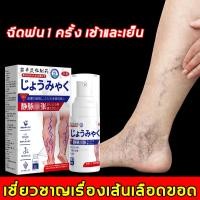 ราคา ครีมทาเส้นเลือดขอด ครีมเส้นเลือด ยาทาเส้นขอด เส้นเลือดขอด รักษาขาให้สวย รักษาขาให้สวย ครีมหลอดเลือดดำบอกล 30ml (23404560839)