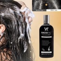ราคา Watermans Grow Me Dandruff Relieving Itching Relieving And F0O2 Not The Shampoo 250ml Damaging (22800324362)
