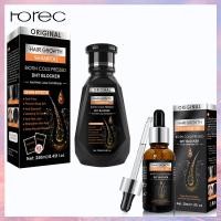 ราคา Horec แชมพูปลูกผมดก แชมพุลดผมร่วง สระผมขิง แชมพูแก้ผมร่วง 260ml แชมพูสมุนไพร สำหรับผมบาง แชมพูปลูกผม แชมพูขิง แชมพูขิงเพียว แชมพูสระผม แชมพูลดผมร่วง ปลูกผม แชมพูผมดก แชมพูสมุนไพรขิงบำรุงผม เซรั่มปลูกผ
