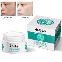 ราคา Hanxiครีมลดฝ้า ครีม แก้ ฝ้า กระ ครีมแก้ฝ้าถาวร 20g vitamin c ครีมแก้ฝ้าแท้ๆ ครีมทาฝ้าหนาๆ ครีมทาฝ้า ครีมลอกฝ้า ทาฝ้าหนาลึก กระ ครีมฝ้ากระลึก ครีมแก้ฝ้ากระ ครีมหน้าขาวใส จุดด่างดำป้องกันริ้วรอย freckle