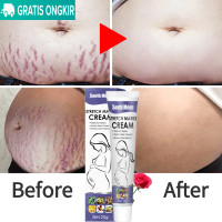 ราคา FDA ลดรอยแผลเป็น รอยแตกลาย ครีมทาท้องลาย ลดรอยแตกลาย ท้องลาย ริ้วรอยจากการตั้งครรภ์ Stretch Mark Cream 20 กรัม (23271071608)