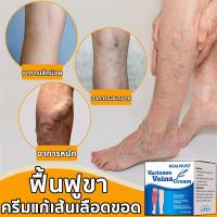 ราคา ไม่ได้ผลคืนเงิน Varicose Vein Cream ครีมทาสำหรับเส้นเลือดขอด ขาสวย ลบเส้นเลือดขอด รักษาขาให้สวย ครีมทาเส้นเลือดขอด ครีมเส้นเลือด ขนาด 20กรัม (23102644879)