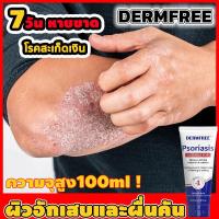 ราคา รักษาอาการคัน สิว หนอง น้ำเหลืองเสีย คัน หิด เชื้อราสะเก็ดเงิน แพ้ สมุนไพรรักษา โรคผิวหนัง รักษาอาการคัน โรคสะเก็ดเงิน กลาก เกลื้อน เชื้อรา กำจัดไวรัสเชื้อแบคทีเรีย ที่ก่อให้เกิดโรคผิวหนังอักเสบ ลดอา 