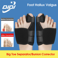 ราคา DIDI 2 ชิ้น 1 คู่ Bunion Splint Big Toe Straightener Corrector บรรเทาอาการปวดเท้า Hallux Valgus การแก้ไขอุปกรณ์ศัลยกรรมกระดูก (21846602348)