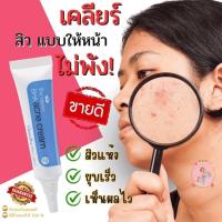 ราคา ส่งฟรี ครีมแต้มสิว สิวหนอง สิว สิวอักเสบ สิวเสี้ยน รอยดำ รอยหลุมสิว สิวอุดตัน แต้ม รอยสิว (23280233153)