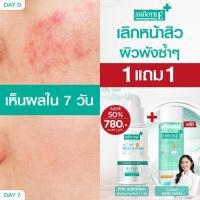 ราคา เซ็ตสุดคุ้ม Smooth E clear Whitening Toner Acne Pro oil control serum เซ็ทสยบสิวซ้ำ ซ่อมผิวพัง คุมมันทันที ใน 7 วัน (24511005999)