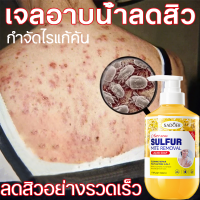 ราคา ครีมอาบน้ำควบคุมสิวที่หลัง ไรฝุ่น บรรเทาอาการคัน ผิวอักเสบ ฟื้นบำรุงผิวเรือนร่าง 500ml สูตรสารส้ม น้ำมันทีทรี (24307019748)