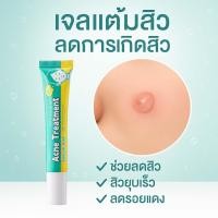 ราคา ANTI ACNE SPOT GEL 20 G เจลแต้มสิวเหมาะสำหรับสิวอักเสบ สิวหัวหนอง (24416948565)