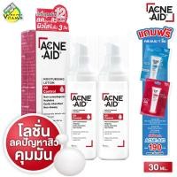 ราคา 2 ขวด Acne Aid Moisturising Lotion Oil Control แอคเน่ เอด มอยซ์เจอร์ไรซิ่ง โลชั่น ออยล์ คอนโทรล 30 ml (18850571189)