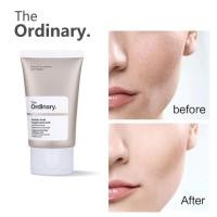 ราคา The Ordinary Azelaic Acid Suspension 10 30ml กำจัดสิวกำจัดสิว ผิวกระจ่างใส ครีม (21733816353)