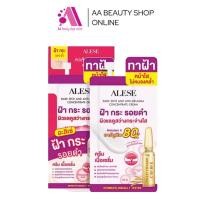 ราคา ส่งฟรี ALESE DARK SPOT AND ANTI MELASMA CONCENTRATE CREAM อะลิเซ่ ครีมฝ้า ลดจุดด่างดํา กระ (22564705436)