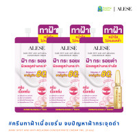 ราคา รวมครีมซอง ALESE เซ็ต 6 ซอง เซรั่มดาร์คสปอต ครีมมอยส์เกาหลี กันแดดกันฝ้า ซีซีปกปิดเนียน (22663648753)