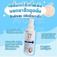 ราคา ส่งด่วน 1 2วัน สเปรย์ฉีดสิวที่หลัง สบู่ Verble ANCE CLEAR BODY SPRAY VERBLE สเปรย์ฉีดสิวที่หลัง ปรับปรุงสิว จุดด่างดำ ผิวกระจ่างใส ของแท้ 100ml (22466430718)