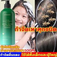 ราคา ป้องกันรังแคและคัน ไม่ทำร้ายหนังศีรษ แชมพูขจัดรังแค500ml ควบคุมความมัน ขจัดรังแค บำรุงรากผม ลดผมร่วง ดูแลหนังศีรษะ แชมพู แชมพูรักษารังแค สระผมเชื้อรา แชมพูแก้ผมหงอก บำรุงหนังศีรษะ สระผมแก้เชื้อรา แชมพ