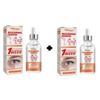 ราคา พร้อมส่ง ครีมบำรุงใต้ตา เซรั่มทาถุงใต้ตา กระชับรอยตีนกา บรรเทาปัญหาต่างๆรอบดวงตา ลบอนุภาคไขมัน (22505626907)