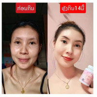 ราคา ยาตุ้ยน้องหมู วิตามินเพิ่มน้ำหนัก กระปุก1 เพิ่มน้ำหนักได้ 3 5 กิโล (23785526866)