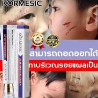 ราคา มีประสิทธิภาพ100 ยาทาแผลเป็น กำจัดรอยแผลเป็น กำจัดรอยแผลเป็น รอยแผลเป็นดำ ให้รอยแผลเป็นจางลงอย่างมีประสิทธิภาพ ลบรอยแผลเป็นสีดำ ครีมทาแผลเป็น ครีมลบรอยแผลเป็น scar gel (24531201321)
