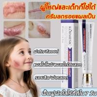 ราคา KORMESIC ยาทาแผลเป็น ครีมทาแผลเป็น ครีมลบรอยแผลเป็น 20ก ทาแผลเป็น ลบรอยแผลเป้น ลบรอยแผลเป็นสีดำ ช่วยให้แผลเป็นจางหายอย่างมีประสิทธิภาพ แผลไฟไหม้ รอยแตกลาย รอยแผลเป็นต่างๆscar removal gel scar cream (2