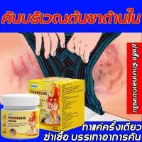 ราคา บรรเทาอาการคัน ครีมลดอาการคัน าสะเก็ดเงิน ผิวหนังอักเสบ ติดเชื้อรา สะเก็ดเงิน แบคทีเรีย คัน กลาก เกลื้อน ครีมแก้คัน (24619713150)