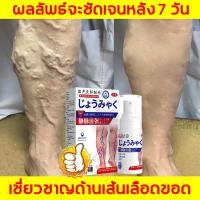 ราคา ของแท้ 100 พร้อมส่ง ยาทาเส้นขอด บรรเทาและลดอาการบวม อาการบวมที่ขา ช่วยบรรเทาอาการปวดขา สเปรย์ฉีดเส้นเลือดขอด ครีมทาเส้นเลือดขอด ครีมทาเส้นเลือดขอด (24464871789)