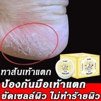 ราคา ครีมทาเท้าแตก ครีมทาเท้า ครีมทาส้นเท้า ครีมทาส้นเท้าแตก ผลิตภัณฑ์ดูแลเท้า ครีมทาส้นแตก ครีมทาเท้าขาว บอกลามือและเท้าแตก ผิวลอก เลือดออกครีมส้นเท้าแตก บำรุงผิวเท้าที่แห้ง ให้เท้าคุณเรียบเนียน (21311819