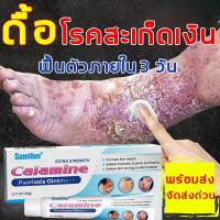 ราคา บรรเทาอาการคัน บรรเทาอาการคัน ครีมลดอาการคัน าสะเก็ดเงิน ผิวหนังอักเสบ ติดเชื้อรา สะเก็ดเงิน แบคทีเรีย คัน กลาก เกลื้อน ครีมแก้คัน (24578900972)