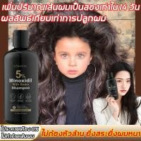 ราคา แก้ปัญหาเส้นผม แชมพูผมร่วง ป้องกันหัวล้าน บำรุงรากผม แชมพูลดผมร่วง 300มล แชมพูเร่งผมยาว ยาสระผมแก้ร่วง แชมพูลดผมร่วง แชมพูขิง (24417585282)