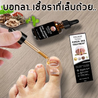 ราคา เซรั่มบำรุงเล็บ เล็บเชื้อรา เล็บเสีย เล็บบาง ซ่อมแซมเล็บ มีปัญหาเล็บมือ เล็บเท้า น้ำยาทาเล็บเชื้อรา 30 ml (24612925113)