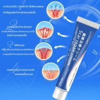 ราคา ครีมทารอยแผลเป็น20g รักษารอยแผลเป็น แผลผ่าตัด ทาแผลเป็น ทาแผลเป็นนูน ครีมทาแผลเป็น ครีมลบแผลเป็น เจล รอยแผลเป็น รอยสิว รอยดำ รอยแดง ทาแผลเป็นนูน ลบรอยแผลเปน Scar removal cream (24438953414)