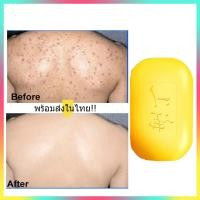 ราคา สบู่ล้างหน้า สบู่กำมะถัน สบู่ก้อน สบู่ซลเฟอร์ สบู่ล้างหน้าใส ปรับปรุงผิวคัน สิวหน้าอก สิวที่หลัง คุมมัน อ่อนโยนไม่ทำให้ผิวแห้ง Sulfur Soap Bar Soap (24239438588)