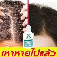 ราคา แชมพูกำจัดเหา 120ml ยาฆ่าเหา ยากำจัดเหา สูตรสมุนไพร กลิ่นหอม น้ำยาฆ่าเหา น้ำยากำจัดเหา แชมพูฆ่าเหา กำจัดเหา ไข่เหา กลิ่นหอม อ่อนโยน ยาฆ่ (24428423295)