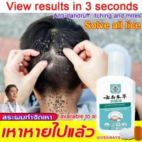 ราคา MIAOXIANFENG แชมพูกำจัดเหา ยาฆ่าเหา 120ml แชมพูกำจัดเหา แม่เหา ลูกเหา ปลอดภัยไม่ระคายเคือง แชมพูฆ่าเหา ไข่เหาสำหรับเด็ก ยาสระผมฆ่าเหา (24428532259)