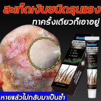 ราคา บรรเทาอาการคัน ครีมลดอาการคัน าสะเก็ดเงิน ผิวหนังอักเสบ ติดเชื้อรา สะเก็ดเงิน แบคทีเรีย คัน กลาก เกลื้อน ครีมแก้คัน (24637708134)