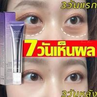 ราคา OCHEAL อายครีม บรรเทารอยหมองคล้ำและอาการ บำรุงรอบดวงตาบำร คงความชุ่นชื้น ลดเลือนริ้วรอย รอยตีนกา (24195845580)