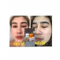 ราคา ครีมไข่มุก ขมิ้นไพ ผสมบัวหิมะแท้100 (22134753583)