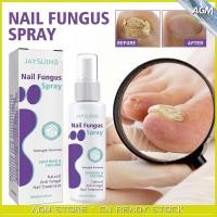 ราคา Medinail Fungal Spray Toenail Fungus Treatment Nail Fungal Treatment Foot Relief Foot Care Tool (22312637576)