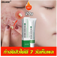 ราคา Jelkeo Dermacare Treatment Gel 20ML Soothing Acne Treatment for Sensitive Dry Skin Long Lasting Moisturizing (21374319353)