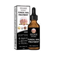 ราคา Nail Care Liquid Hand Foot Thicken Brighten Nail Grey Nail Moisturise Nails (24598175721)