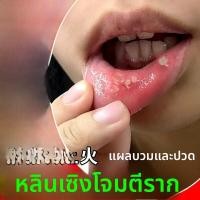 ราคา ยาสเปรย์ฟื้นฟูเยื่อบุปากสำหรับแก้ปัญหาปากเปื่อยและแผลในปาก บรรจุภัณฑ์กล่อง ผลิตจากจีนแผ่นดินใหญ่ (24022198357)