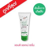 Kisaa Anti Acne Moisturizing Serum 10ml