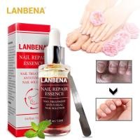 ราคา Amortals LANBENA Upgraded Version Nail Repair Essence Serum Fungal Nail Treatment Remove Onychomycosis Toe Cracked Rough nails Nourishing Brighten Foot Skin Care (3738006207)