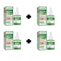 ราคา ซื้อ 1 แถม 1 ครีมแต้มสิว 30ml ละลายหัวสิว ไม่อุดตันผิว รูขุมขนกระชับ อ่อนโยนไม่ระคายเคือง (22497845771)